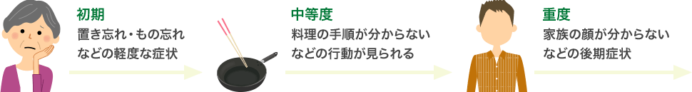 アルツハイマー型認知症の段階別症状